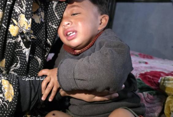 مهران لشهاب: تعذيب طفل عمره عام في غزة قمة الانحطاط الأخلاقي ويتطلب رداً دولياً حاسماً