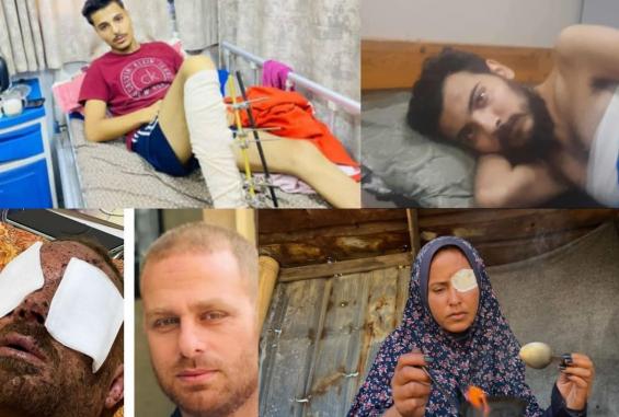 قصص جرحى غزة تكشف حجم الانهيار الطبي في القطاع