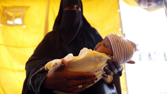 "الكوليرا" يحصد أرواح 1500 يمني خلال شهرين