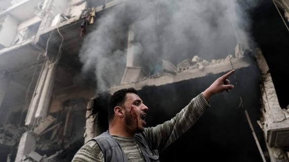 مشاهد من القصف على مدينة دوما في الغوطة الشرقية الذي خلف شهداء وجرحى