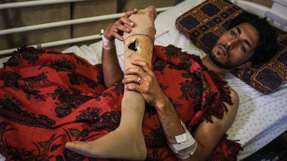 الشاب الفلسطيني إياد الدواهيد يفقد ساقه الاصطناعية في مسيرة العودة برصاصة إسرائيلية