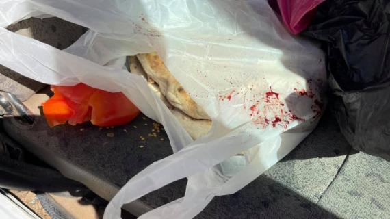 خبز مغمس بالدم.. إصابة طفل برصاص أطلقته  قوات الاحتلال على مركبة شمال الخليل