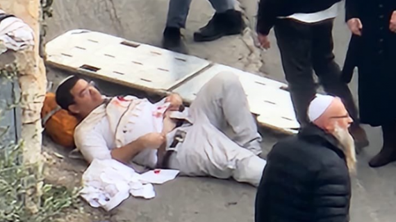 إصابة مستوطنيْن بعملية إطلاق نار في سلوان بالقدس المحتلة