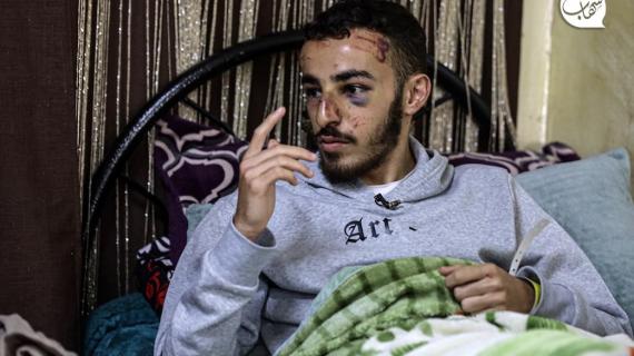 الفتى محمد عويسات 17 عامًا من جبل المكبر بالقدس المحتلة يرقد على سريره مصابًا بكسر في الأنف وكدمات في الرأس والظهر بعد تعرضه للضرب من قبل جنود الاحتلال الإسرائيلي