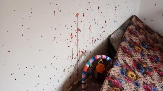 آثار عملية اغتيال قوات الاحتلال للشهيد أمير أبو خديجة