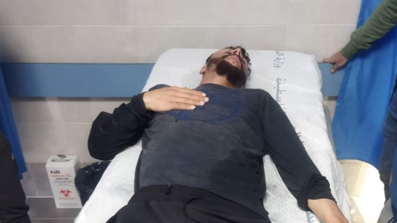 إصابة أربعة صيادين برصاص الاحتلال المعدني في عرض بحر مدينة غزة