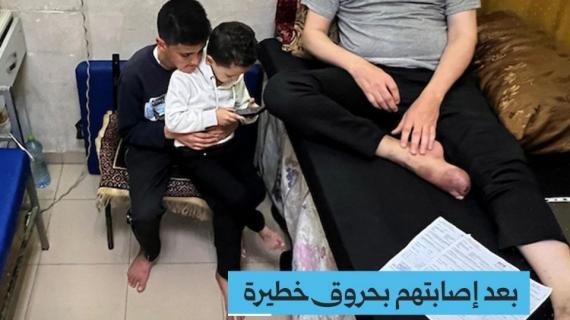 بعد إصابتهم بحروق خطيرة.. عائلة ياسر ديب تنتظر علاجاً خارج غزة