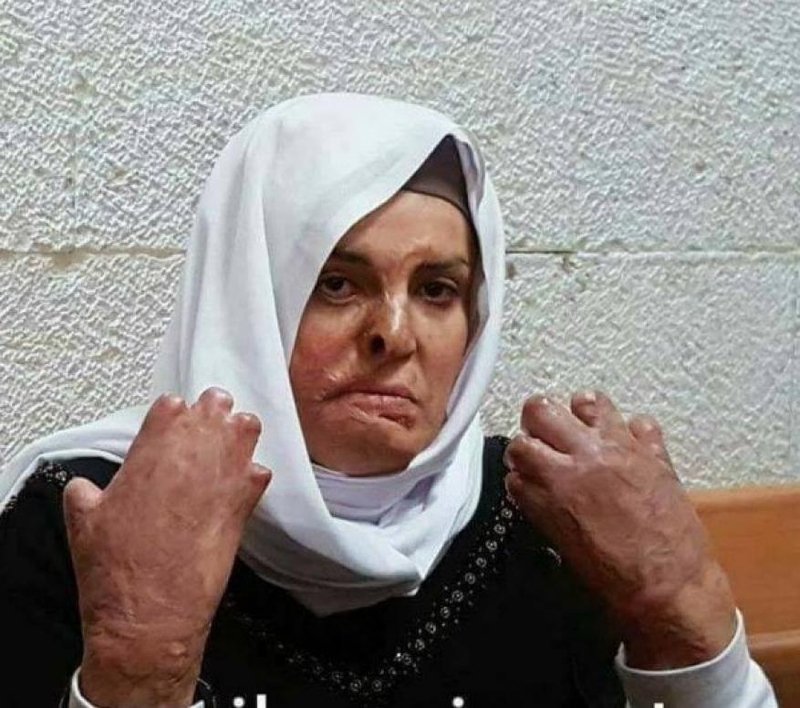 الاحتلال يرفض إجراء عمليات جراحية للأسيرتين الجريحتين الجعابيص وطقاطقة