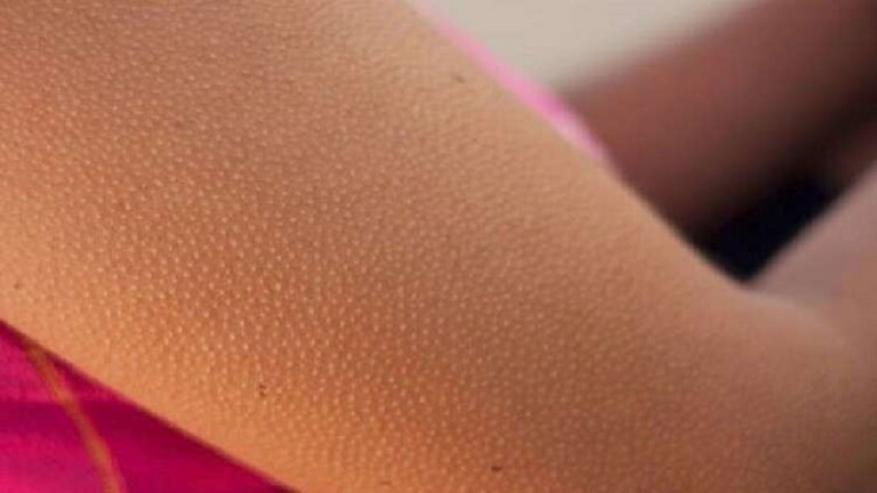 معلومة جديدة عن "القشعريرة" توصل إليها علماء هارفارد.. قد تُصدمك