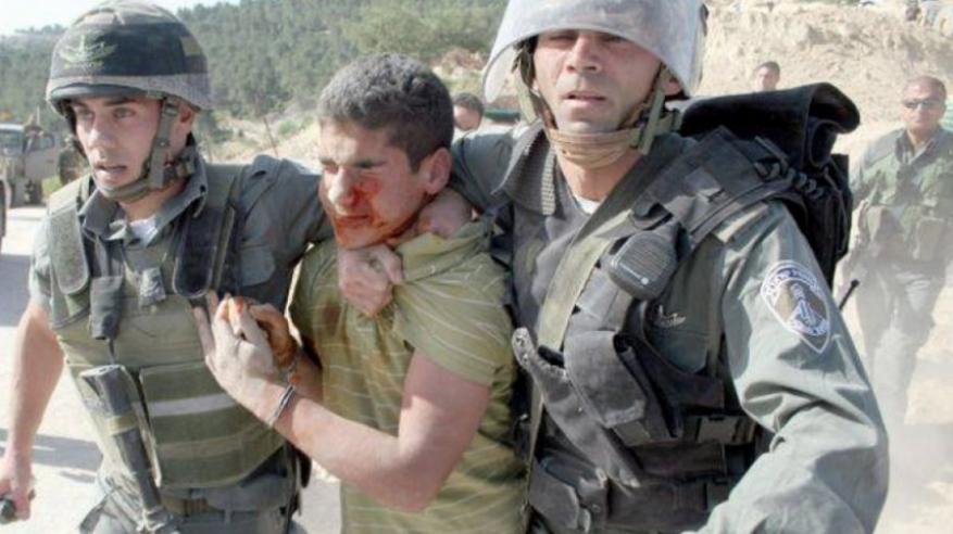 تفاصيل قاسية عن تعذيب قوات الاحتلال فتى مقدسيًّا صعقًا بالكهرباء