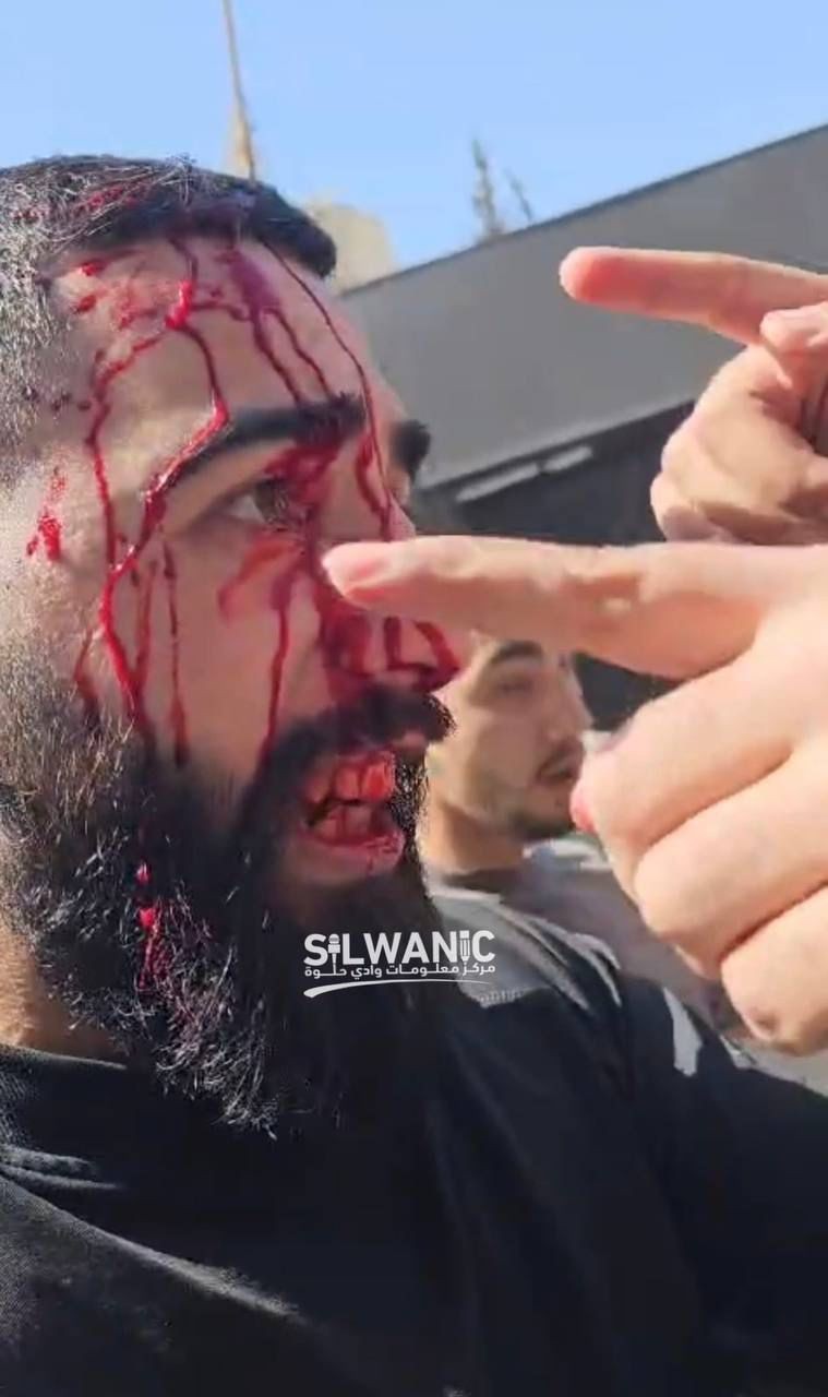 6eacc414-f4b9-4a4b-b9cb-d853ee28dc3e.jfif