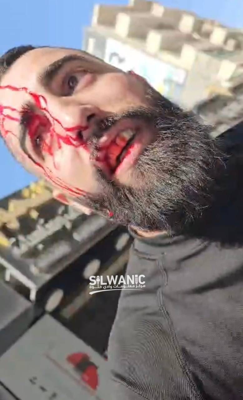 fddd46c9-36e1-4a70-aa79-3ba519ff8e8f.jfif